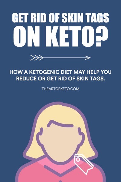 Keto diet and skin tags pinterest